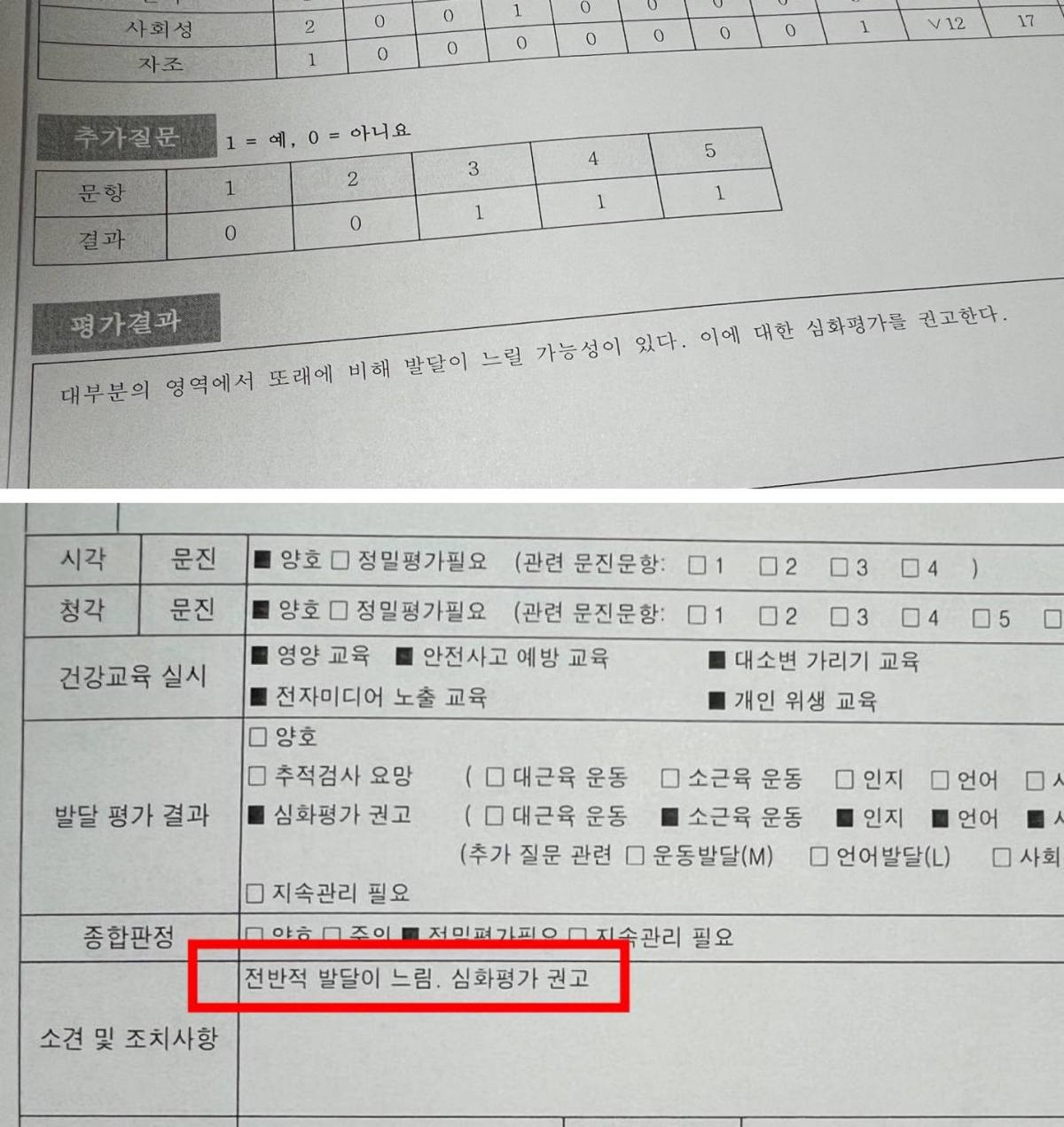 자폐 초기 증상
